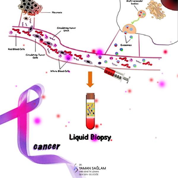 Likit Biyopsi’nin Kanser ile ilişkisi nedir?